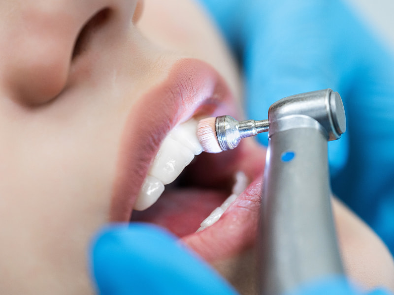 Regular Dental Cleanings