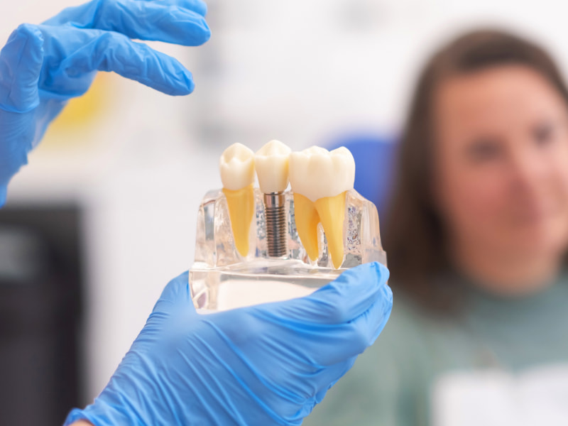 Transform your Smile with Dental Implants